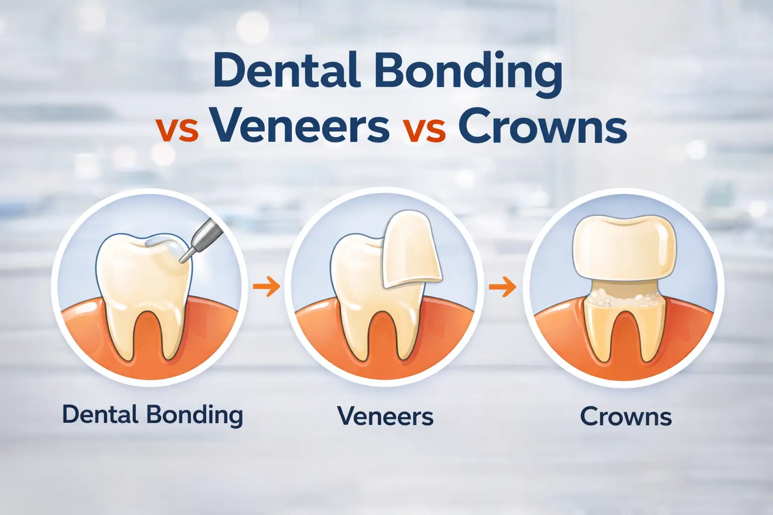 Dental Bonding vs Veneers vs Crowns