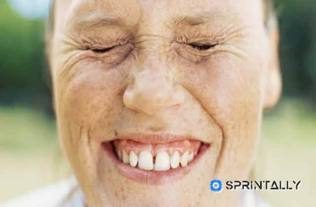 80 percent of wrinkles a woman gets from that allows your face to the sun